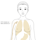 Breathe Deeply: Unlock Lung Health with Acupressure Points LU 1 & LU 2 - YINA