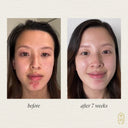 Clarify Botanical Serum - YINA