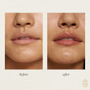 Recovery Lip Treatment - YINA
